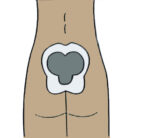 ⁦Suprasorb® P sensitive Sacrum - חבישת קצף בעלת מגע סיליקון לסקרום⁩ – תמונה ⁦2⁩