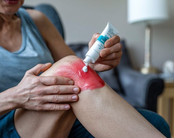 בעיות עור עיקשות