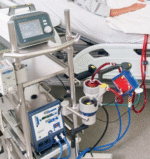 ⁦אקמו – ECMO  ELSO⁩ – תמונה ⁦4⁩