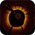 ⁦OPTICAL COHERENCE TOMOGRAPHY⁩ – תמונה ⁦4⁩