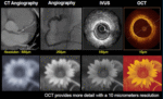 ⁦OPTICAL COHERENCE TOMOGRAPHY⁩ – תמונה ⁦2⁩