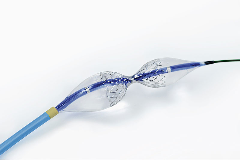 Reducer-on-balloon.jpg התקן ה REDUCER של חברת Neovasc לטיפול בתעוקה עיקשת – תמונה 1